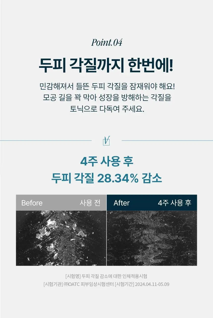 [탈모 전문가 토닉] 솔랩 탈모/민감두피 진정 미스트 토닉 100ml 상세페이지 21